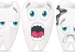Как лечить кариес зубов?