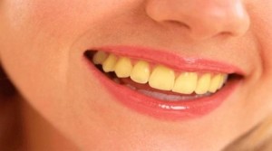 Желтые зубы - причины