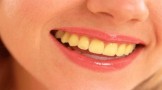 Желтые зубы — 6 продуктов, которые приводят к желтизне зубов